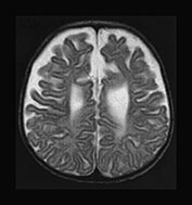 Fig. 17.9 (h)
