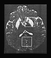 Fig. 17.10 (a)