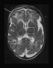 Fig. 17.11 (b)
