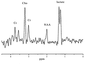 Fig. 17.11 (c)