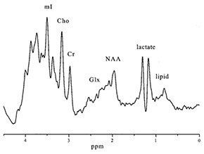 Fig. 17.11 (d)