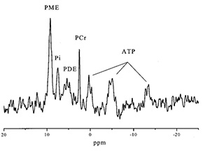 Fig. 17.11 (e)