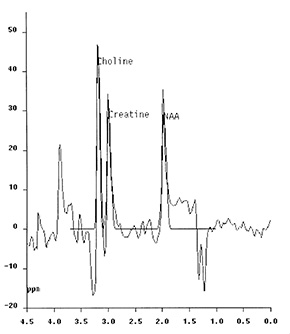 Fig. 17.12 (a)