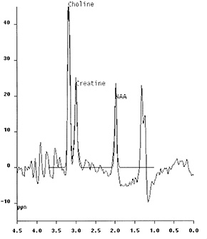 Fig. 17.12 (b)