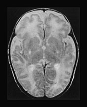 Fig. 17.13 (b)