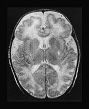 Fig. 17.13 (c)