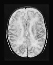Fig. 17.13 (d)