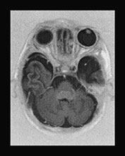 Fig. 17.13 (e)