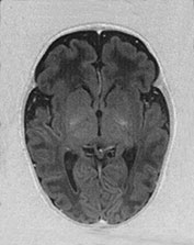 Fig. 17.13 (f)