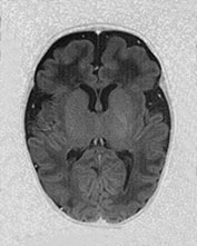 Fig. 17.13 (g)
