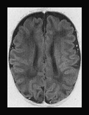 Fig. 17.13 (h)