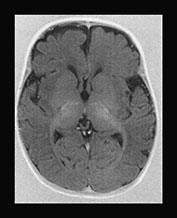 Fig. 17.14 (b)