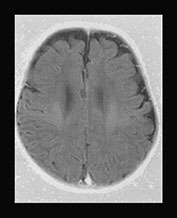 Fig. 17.14 (c)