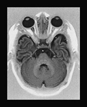 Fig. 17.14 (d)