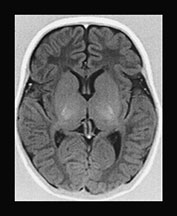 Fig. 17.14 (e)