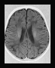 Fig. 17.14 (f)
