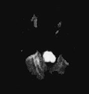 Fig. 17.15 (a)