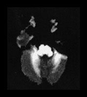 Fig. 17.15 (b)