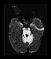 Fig. 17.15 (d)