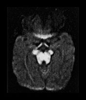 Fig. 17.15 (e)