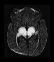 Fig. 17.15 (f)
