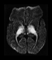 Fig. 17.15 (g)