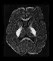 Fig. 17.15 (h)