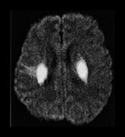 Fig. 17.15 (i)