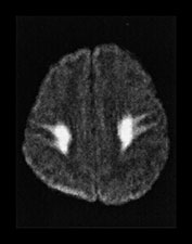 Fig. 17.15 (j)
