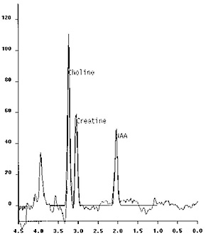 Fig. 17.16 (a)