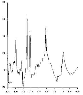 Fig. 17.16 (b)