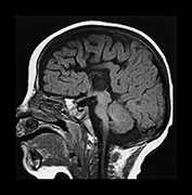 Fig. 17.17 (a)