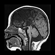 Fig. 17.17 (b)
