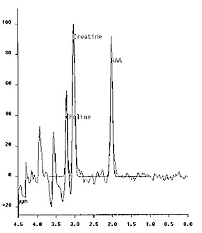Fig. 17.18 (b)