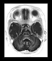 Fig. 17.19 (a)