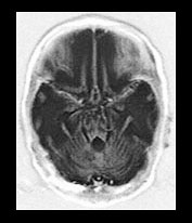 Fig. 17.19 (b)