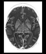 Fig. 17.19 (c)