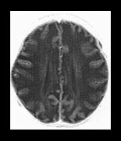 Fig. 17.19 (d)
