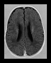 Fig. 17.21 (d)