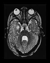 Fig. 17.21 (e)