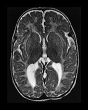 Fig. 17.21 (f)