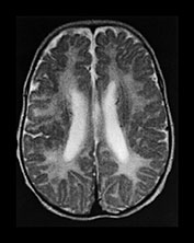 Fig. 17.21 (h)