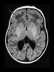 Fig. 17.23 (a)