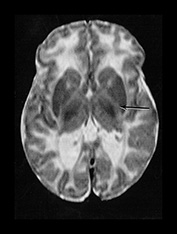 Fig. 17.23 (b)